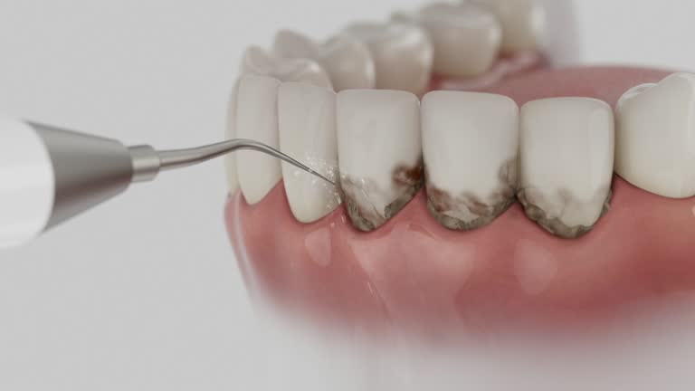 Reliable Dental Implants contractor in Stockton, MO by Smile Center Dentistry